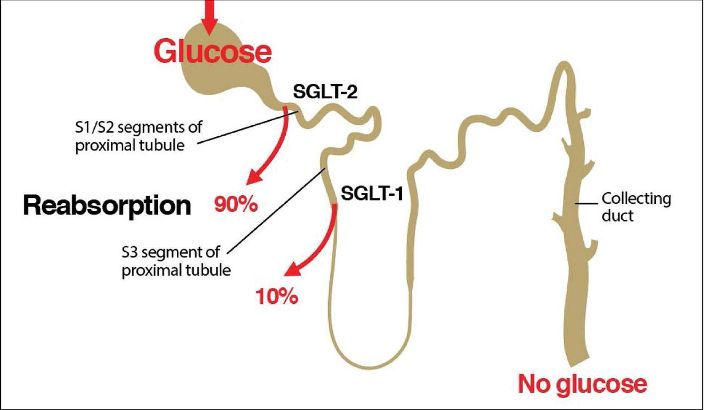 SGLT2 inhibitörleri alan hastalarda yeni tanımlanan bir